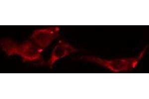 ABIN6275018 staining  Hela cells by IF/ICC.