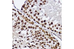Immunohistochemistry (IHC) image for anti-General Transcription Factor IIF, Polypeptide 2, 30kDa (GTF2F2) antibody (ABIN7267373)