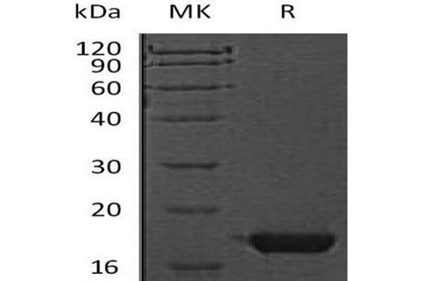 CST7 Protein (His tag)