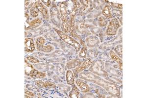 Immunohistochemistry of paraffin-embedded mouse kidney using Sterol carrier protein 2 Rabbit mAb (ABIN7270597) at dilution of 1:100 (40x lens). (SCP2 抗体)