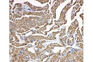 IHC-P: Troponin C antibody testing of rat heart tissue (TNNC1 抗体  (N-Term))