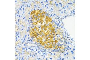 Immunohistochemistry of paraffin-embedded rat islets of langerhans using CCND1 antibody. (Cyclin D1 抗体  (C-Term))