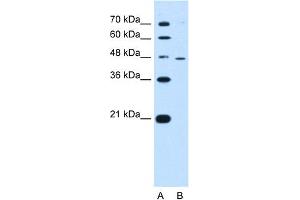 WB Suggested Anti-RNF25 Antibody Titration:  0. (RNF25 抗体  (Middle Region))