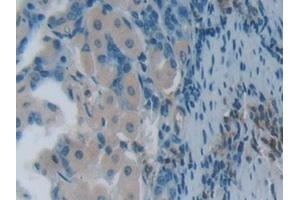 Immunohistochemistry (IHC) image for anti-Plastin 3 (PLS3) (AA 5-251) antibody (ABIN7439222)