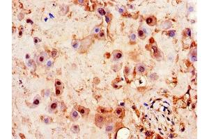 Immunohistochemistry of paraffin-embedded human placenta tissue using ABIN7163469 at dilution of 1:100 (PITX3 抗体  (AA 10-200))