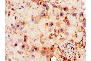 Immunohistochemistry of paraffin-embedded human placenta tissue using ABIN7163469 at dilution of 1:100