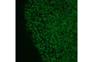 Immunofluorescence analysis of human iPS cells using NANOG antibody (green). (Nanog 抗体  (AA 20-166))