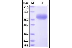 Human Osteoprotegerin, His Tag on SDS-PAGE under reducing (R) condition. (Osteoprotegerin Protein (AA 22-401) (His tag))