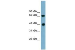 Image no. 1 for anti-Cyclin J (CCNJ) (AA 71-120) antibody (ABIN6744171) (Cyclin J 抗体  (AA 71-120))