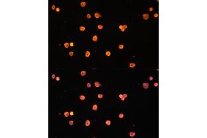 Immunofluorescence (IF) image for anti-Ectonucleoside Triphosphate diphosphohydrolase 1 (ENTPD1) (AA 1-180) antibody (ABIN1679729)