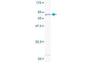 Image no. 1 for serine/threonine Kinase 32B (STK32B) (AA 1-414) protein (GST tag) (ABIN1321688)