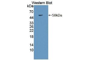 Western blot analysis of the recombinant protein. (IQGAP1 抗体  (AA 1276-1657))