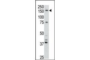 Image no. 1 for anti-ATP-Binding Cassette, Sub-Family B (MDR/TAP), Member 4 (ABCB4) (Center) antibody (ABIN358591) (ABCB4 抗体  (Center))