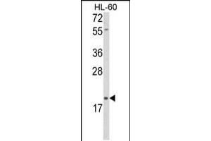 Western blot analysis of DLK2 Antibody in HL-60 cell line lysates (35ug/lane) (DLK2 抗体  (C-Term))