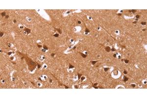 Immunohistochemistry of paraffin-embedded Human brain tissue using Cyclin D3 Polyclonal Antibody at dilution 1:40 (Cyclin D3 抗体)
