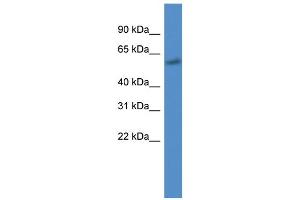 WB Suggested Anti-CYP7B1 AntibodyTitration: 1. (CYP7B1 抗体  (C-Term))