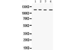 Western blot analysis of UBA1 expression in rat liver extract (lane 1), mouse liver extract (lane 2), mouse testis extract (lane 3) and HELA whole cell lysates (lane 4). (UBA1 抗体  (N-Term))