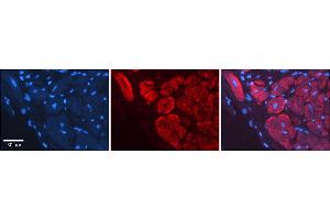 Immunohistochemistry (IHC) image for anti-Wingless-Type MMTV Integration Site Family, Member 5A (WNT5A) (Middle Region) antibody (ABIN2779470)
