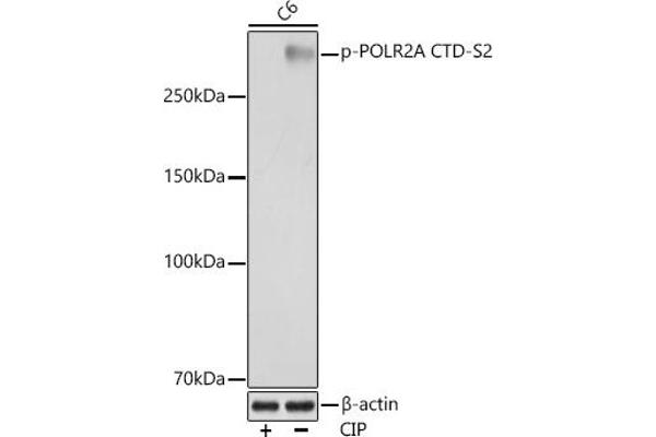 POLR2A/RPB1 抗体  (pSer2)