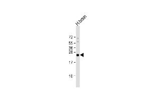 Anti-ARHB Antibody (Center) at 1:4000 dilution + human brain lysate Lysates/proteins at 20 μg per lane.