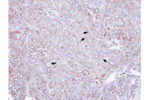 IHC-P Image Immunohistochemical analysis of paraffin-embedded DLD1 xenograft , using CAP1, antibody at 1:500 dilution. (CAP1 抗体  (Center))