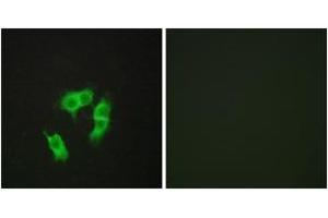 Immunofluorescence analysis of HepG2 cells, using ARMX3 Antibody.
