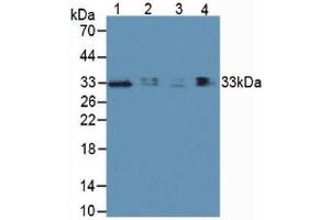Western blot analysis of (1) Human Lung Tissue, (2) Human Hepg2 Cells, (3) Human 293T Cells and (4) Porcine Lymph Node Tissue. (TIM3 抗体  (AA 22-202))