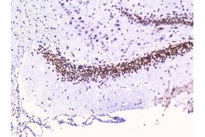 IHC analysis of RbAp48 using anti-RbAp48 antibody (ABIN5692929).