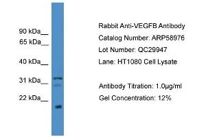 WB Suggested Anti-VEGFB  Antibody Titration: 0. (VEGFB 抗体  (C-Term))