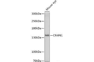 Western blot analysis of extracts of Mouse eye using CFAP61 Polyclonal Antibody at dilution of 1:1000. (CFAP61 抗体)