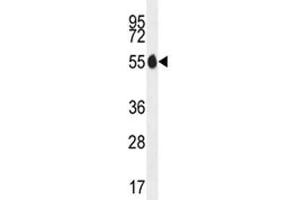 PAX1 antibody western blot analysis in MDA-MB435 lysate. (PAX1 抗体  (AA 163-189))