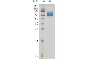 SDS-PAGE (SDS) image for Transforming Growth Factor, beta Receptor II (70/80kDa) (TGFBR2) (AA 23-159) protein (Fc Tag) (ABIN6964330)