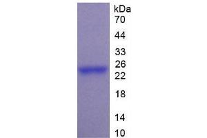 SDS-PAGE of Protein Standard from the Kit (Highly purified E. (PTF1A ELISA 试剂盒)