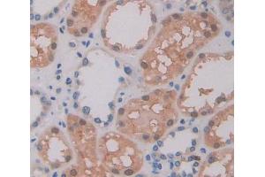 Used in DAB staining on fromalin fixed paraffin- embedded kidney tissue (ABCA9 抗体  (AA 1423-1590))