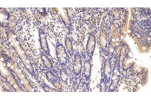 Detection of FAS in Porcine Small intestine Tissue using Polyclonal Antibody to Factor Related Apoptosis (FAS) (FAS 抗体)