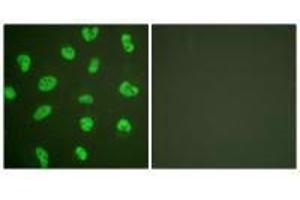 Immunofluorescence analysis of HeLa cells, treated with Forskolin (40nM, 30 mins), using DNA-PK antibody. (PRKDC 抗体)
