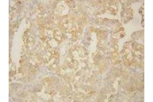 Image no. 2 for anti-Matrix Metallopeptidase 9 (Gelatinase B, 92kDa Gelatinase, 92kDa Type IV Collagenase) (MMP9) (AA 689-705) antibody (ABIN1493479)