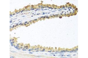 Immunohistochemistry of paraffin-embedded Human prostate using COCH Polyclonal Antibody at dilution of 1:100 (40x lens). (COCH 抗体)