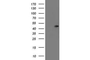 HEK293T cells were transfected with the pCMV6-ENTRY control (Left lane) or pCMV6-ENTRY SERPINA5 (Right lane) cDNA for 48 hrs and lysed. (SERPINA5 抗体)