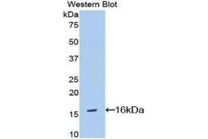 Western Blotting (WB) image for anti-Interleukin 18 Receptor 1 (IL18R1) (AA 391-518) antibody (ABIN1174881) (IL18R1 抗体  (AA 391-518))