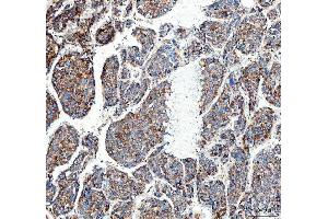 IHC analysis of MUT using anti-MUT antibody (ABIN4886676). (MUT 抗体  (N-Term))