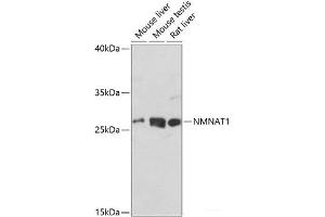 Western blot analysis of extracts of various cell lines using NMNAT1 Polyclonal Antibody at dilution of 1:1000. (NMNAT1 抗体)
