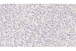 Detection of MT1 in Rat Liver Tissue using Polyclonal Antibody to Metallothionein 1 (MT1) (MT1 抗体  (AA 1-61))