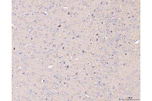 IHC analysis of MT-CO2 using anti-MT-CO2 antibody (ABIN7599081). (COX2 抗体  (AA 1-205))