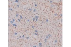 Used in DAB staining on fromalin fixed paraffin- embedded Kidney tissue (CDH23 抗体  (AA 34-236))