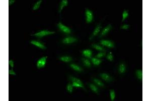 Immunofluorescence staining of Hela cells with ABIN7164337 at 1:100, counter-stained with DAPI. (DDX17 抗体  (AA 591-692))