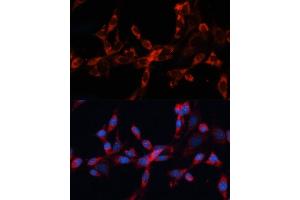 Immunofluorescence analysis of NIH/3T3 cells using Cathepsin L/V/K/H antibody (ABIN6127670, ABIN6139235, ABIN6139237 and ABIN6215636) at dilution of 1:100. (Cathepsin L 抗体  (AA 114-333))