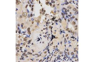 Immunohistochemistry (Paraffin-embedded Sections) (IHC (p)) image for anti-Histone 3 (H3) (H3K36me2) antibody (ABIN3016036)
