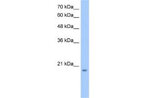 WB Suggested Anti-MGC4172 Antibody Titration:  0. (MGC4172 (C-Term) 抗体)