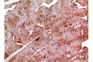 Immunohistochemistry (IHC) image for anti-Inhibin, beta E (INHBE) (C-Term) antibody (ABIN3187819)